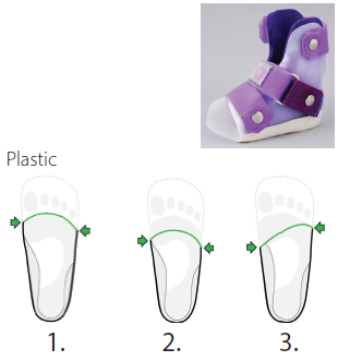 Diagram of easy toe-off trimline options
