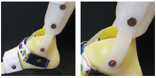 Pictured free ankle trimlines on a DAFO 2