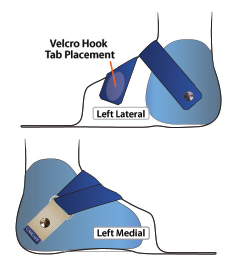 Diagram of a Y instep strap