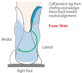 Diagram explaining lateral shim pad function