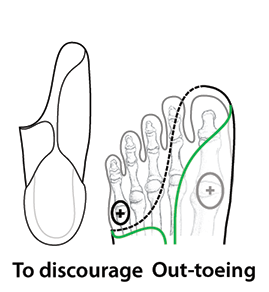 Diagram showing plantar surface cut away from the 3rd to 5th met heads