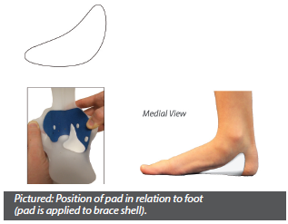 Pictured pronation control pad