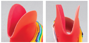 Pictured a medial shim pad in a DAFO 4