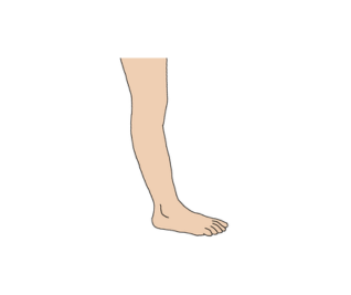 No or slight plantarflexion
