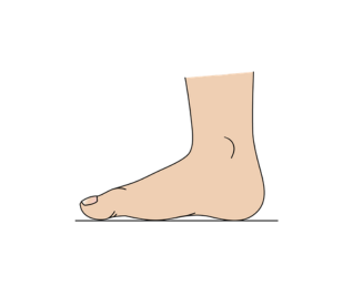 Regular or slight difference, either raised or lowered 
