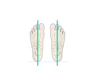  Regular or slight abduction/adduction