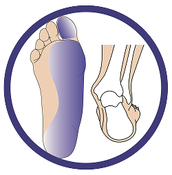 Low Tone Pronation