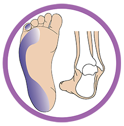 High Tone Pronation