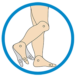 This image showcases the structure of the foot that is suffering from Swing Phase Inconsistency