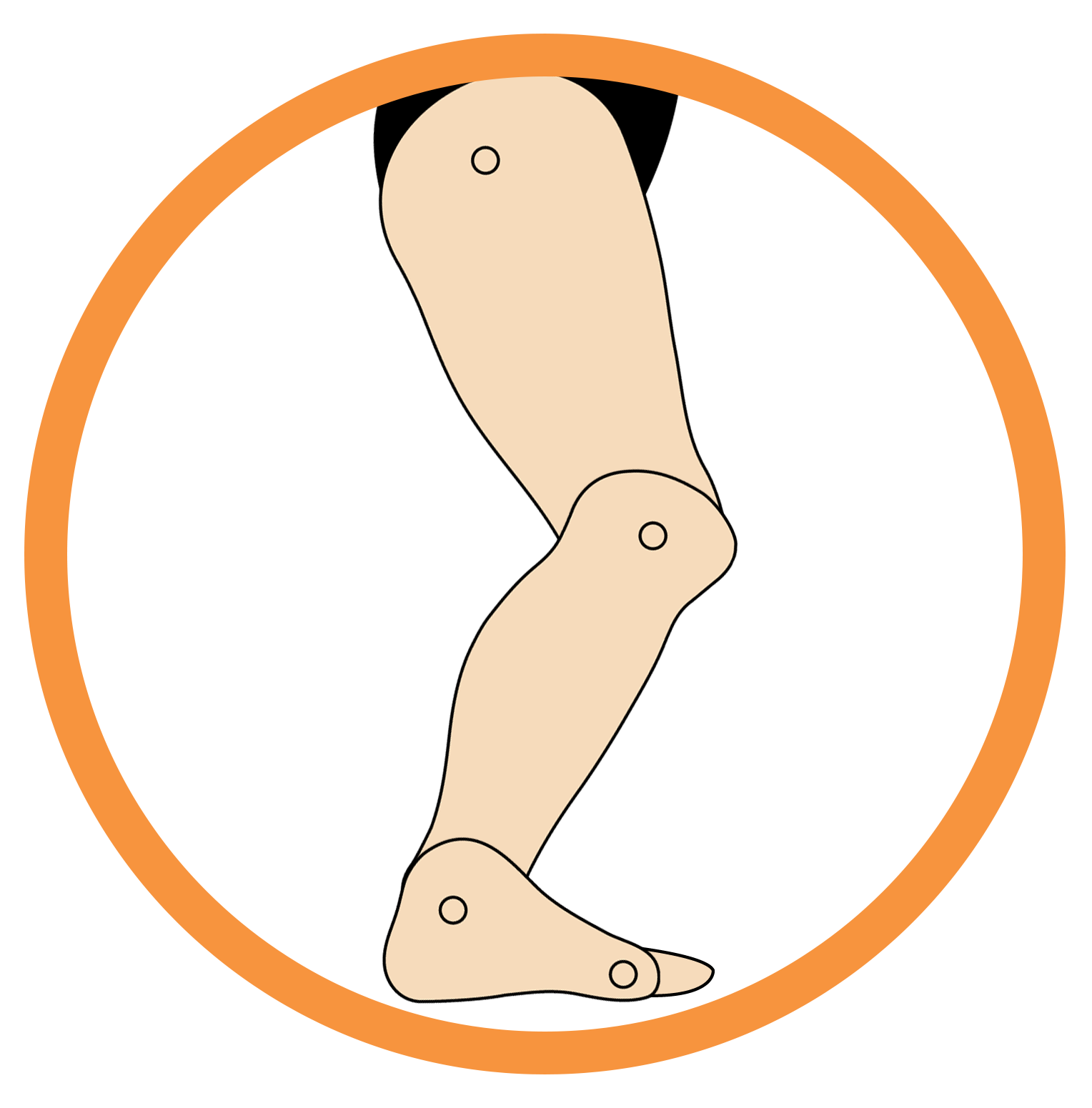 This image showcases structure of the foot that is suffering from Excess Dorsiflexion