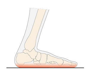Weight-Bearing
